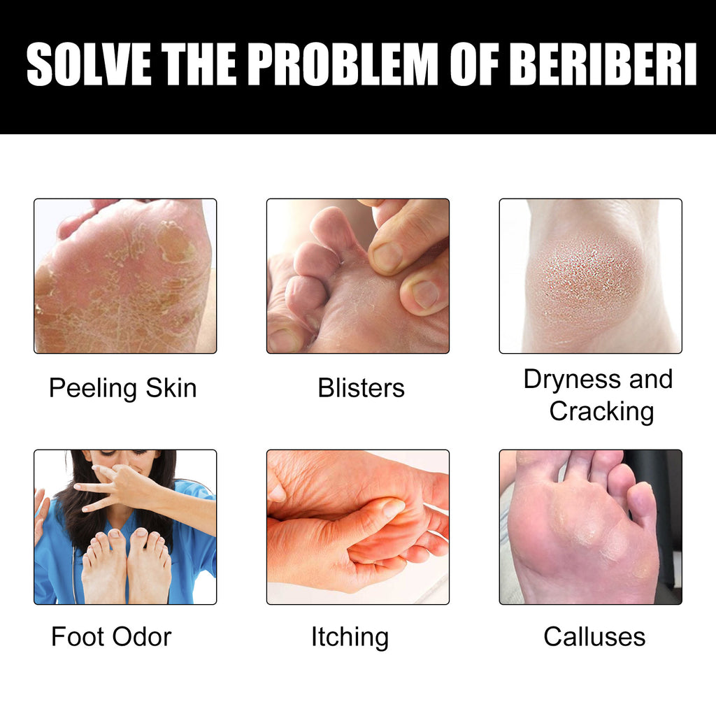 Foot Deodorant Cream Anti-itching Deodorant Anti-rot Feet Dry Peeling Care